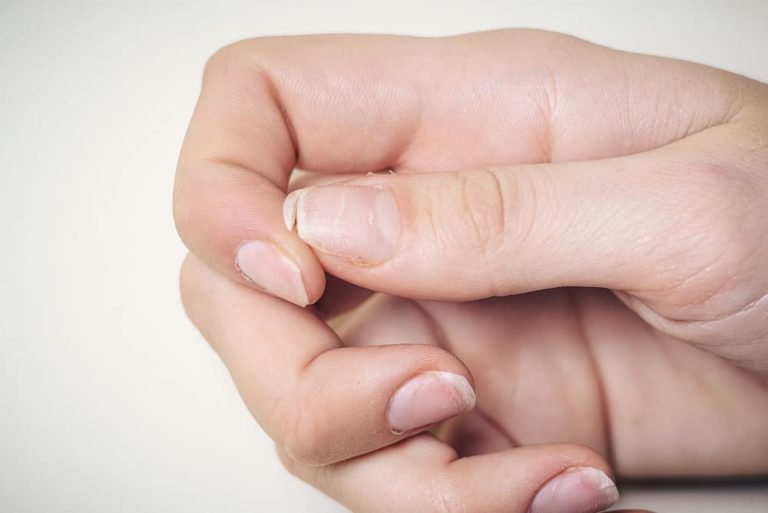 Móng tay bị gãy thiếu chất gì? Cách để dưỡng móng tay dài, đẹp - chothuoctay