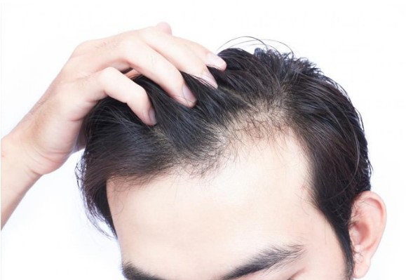Tips chọn dầu gội dưỡng tóc cho nam